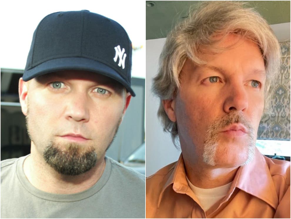 Limp Bizkit’s Fred Durst dramatically changed his look and people are